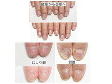 ルクレール カシェット(Le clair cachette)の雰囲気(平爪や深爪、ネイルケア自爪育成で指先までも潤い縦長美爪へ!)