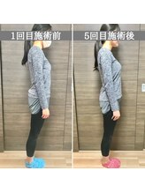 シェア 人形町店(Chare)/【小顔・骨盤矯正・О脚・整体】
