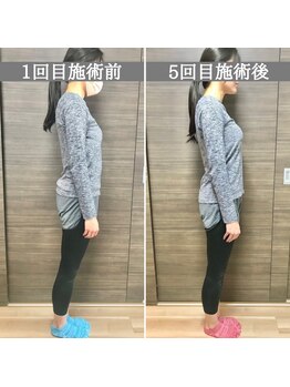 シェア 人形町店(Chare)/【小顔・骨盤矯正・О脚・整体】