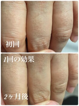 イーストモア(EAST MOIS)/体は１か月半～２か月の間隔で