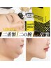 [◎二重アゴ卒業!]☆最新レモンボトル脂肪分解+RFリフトで何回通わずに小顔！