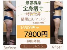 ダイエット サポート(DIET SUPPORT)