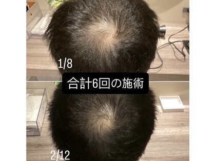 オレオール(aureole)の写真