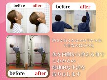 みずき整骨院 骨盤本舗/