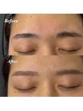 ブリス 姫路(Bliss)/お客様Before/After