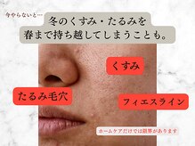 リボーン 柏(REBORN)/肌管理&リフトアップが同時に◎