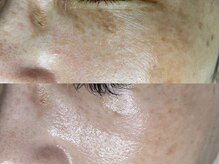 ソワラ(Soiela)の雰囲気（《シミ・肌質改善》年齢を重ねて出来たシミも◎）