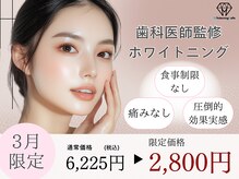 ホワイトニングカフェ 宜野湾店(WhiteningCafe)