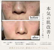 アトレ