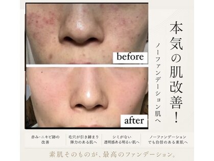 アトレの写真