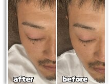 サロン ド ララ(Salon de LALA)の雰囲気（一度の施術でこのスッキリ感！光フェイシャル×ヘッドスパが◎）