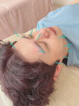 ヒーリングサロン アージュ(A-je)/★美顔鍼＋小顔矯正★