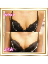 ジュエルリング(Jewel Ring)/バストアップ【恵比寿代官山】