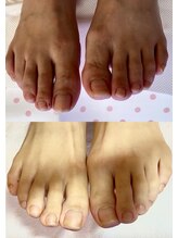 ビサンテ サロン/爪の悩みを解消・Footネイル自爪