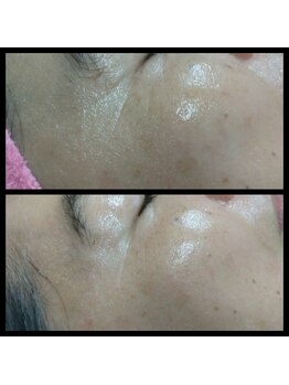 ビューティースリム タニダ/