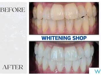 ホワイトニングショップ熊本東店/ホワイトニングショップ熊本東店