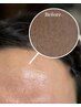 フェイスWAX：角質&産毛OFFでツルツルモテ肌！