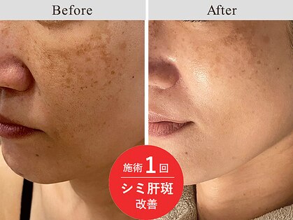 ちゅらせんとの写真