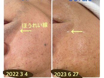 ラボーテ(La Beaute)/