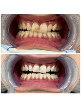 コナホワイトニング 神保町/セルフホワイトニング神保町