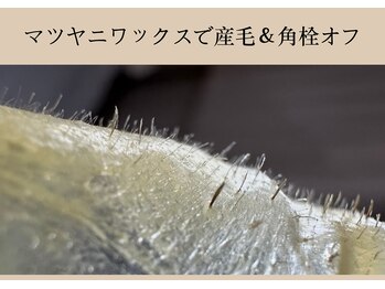 ソーヴ(SOLVE)/くすみの原因は産毛かも。顔脱毛