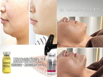 ミロク(369)の写真/【理想のフェイスラインに♪】脂肪分解成分導入・プラズマリンパケアetc気になる部分にアプローチし小顔に