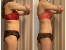 アンベリーノ/シータ波リンパマッサージ