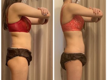 アンベリーノ/シータ波リンパマッサージ