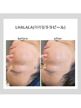 ポムハヌル(pom.haneul)/韓国肌管理室