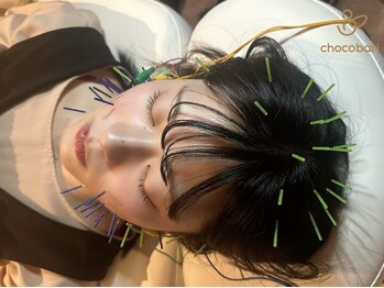 チョコバリ 渋谷店(chocobari)の写真/【微弱電流美容鍼】で小顔×美肌を叶える◎むくみもスッキリ取れてお肌のトーンUP・目のクマ・シミシワ改善