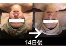 スリーピングレディ(Sleeping Lady)/フェイス