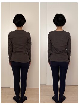 ビーラボ(Be Lab)/全身矯正 施術Before→After