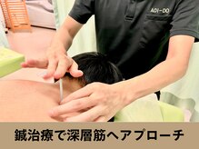 整骨院葵堂 本院の雰囲気（鍼施術を組み合わせることでさらに深いところまでアプローチ◎）
