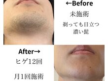 スキンスタジオトウキョウ(SKIN STUDIO TOKYO)の雰囲気（痛みが少ないから、痛いのが苦手な方に最適[日野/メンズ脱毛/髭]）