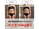 スラン(Slan)の写真