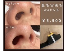 鼻毛脱毛ができるお店！ワックス＆光脱毛でキレイ長持ち！