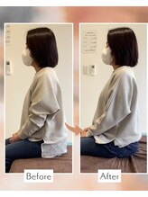藤沢南口整体サロン/40代女性　巻き肩&骨盤矯正