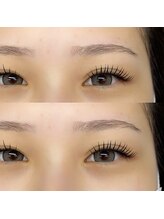 エレヴィ(elevi)/Lカール