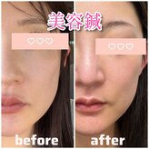 きむら整骨院 鍼灸院