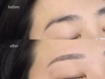 レーヴラグゼ(REVE LUXE)/before/after