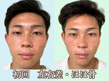 ナチュラルビューティーフェイス 横浜(NBF)/初回20才メンズ小顔矯正