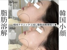 エステティック リベル キョウト 京都駅前店(Esthetic Liber Kyoto)/韓国小顔コルギ×脂肪分解