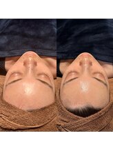 マヴィ くずは店(MavY.)/水光肌へ