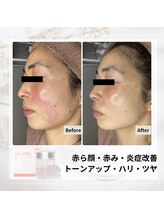 ルアナ(Luana)/ララピールの効果★