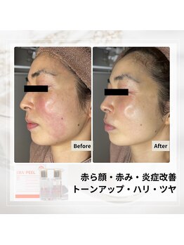 ルアナ(Luana)/ララピールの効果★