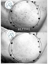 レリア(Reria)/ガリレオピーリング【白黒】