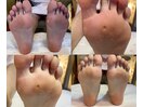 角質ケア&自爪ケアFootcare人気