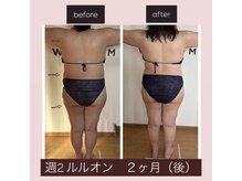 ヨサパーク リアン(YOSA PARK Lien)/モニター様before→after/痩身