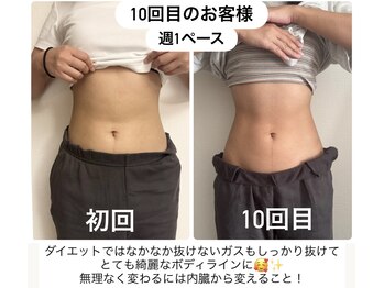 ネネ(Nene)/ビフォーアフター