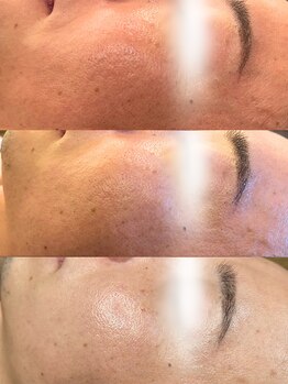 ヘアーアンドエステ ハラダ 滝ノ水店/アンストレス2回の施術の結果